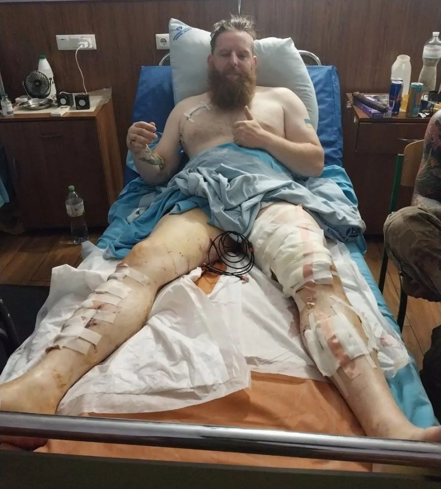 James Sutton has survived after being hit by a sniper's bullet in Ukraine