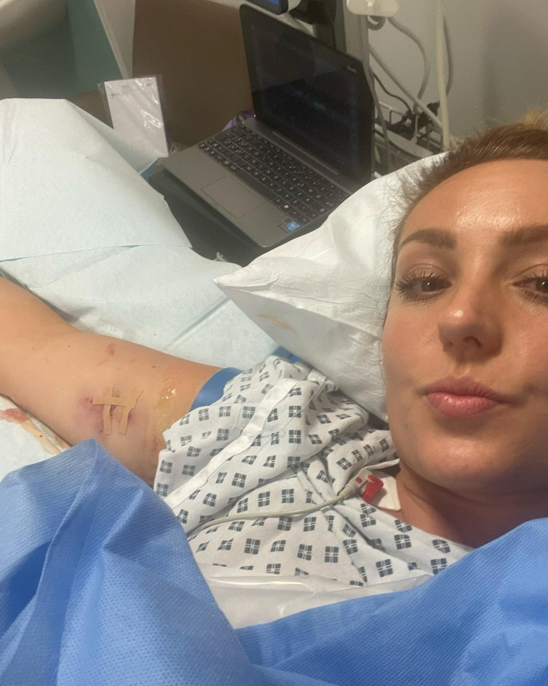 Amy Dowden, who battled sepsis, pictured in hospital