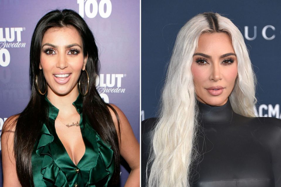 Kim Kardashian before and after Botox