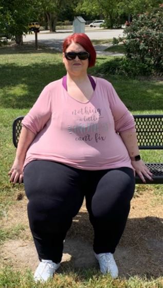 Amanda lost weight so she could safely have the surgery she needed