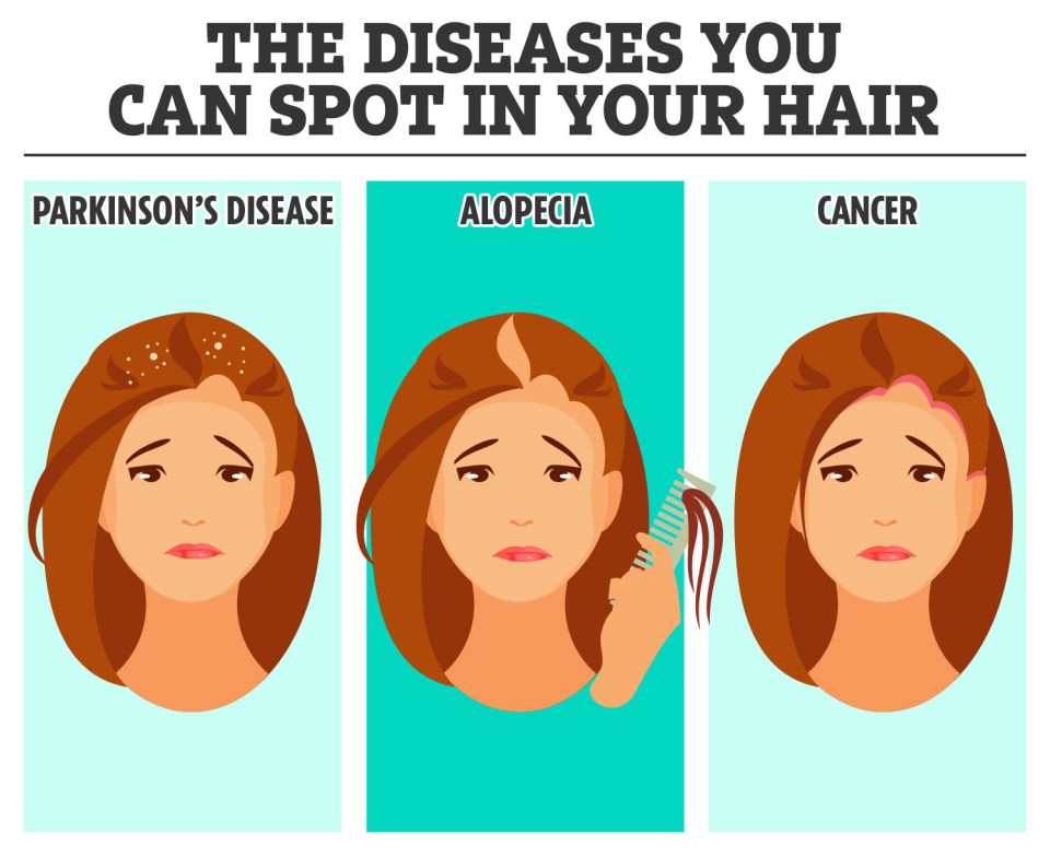 Your hair can reveal a lot about your health