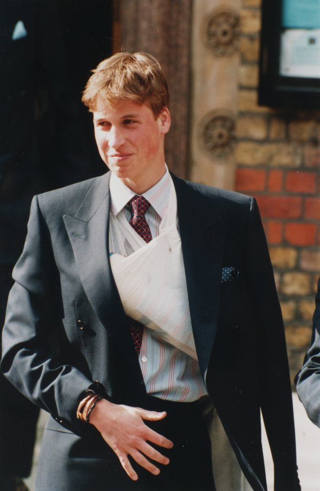 Prince William broke his finger in 1999