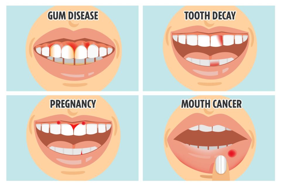 Sensitive teeth could mean you have gum disease, while round growths on your gums could be a sign that you have a bun in the oven