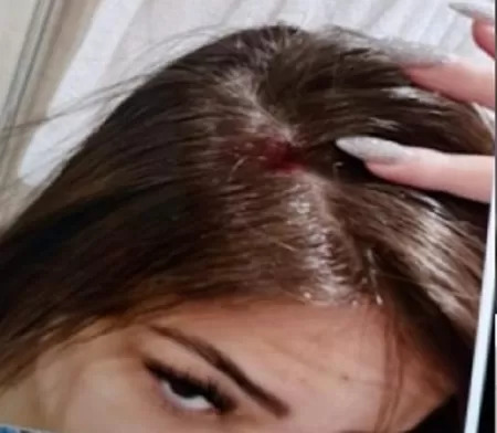 She also shared images showing injuries to her head