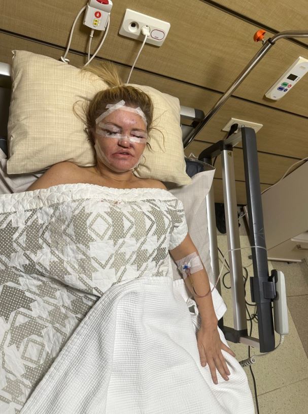 But the EastEnders icon thought she'd die in her fifth facial surgery in Turkey