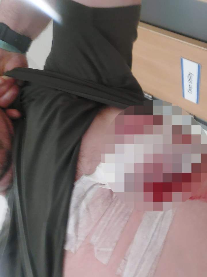 The builder shared pictures of his horrific injuries after the attack