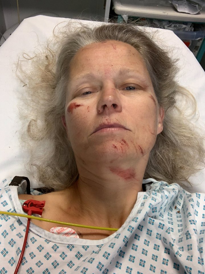 Janet needed hospital care when she was attacked last year