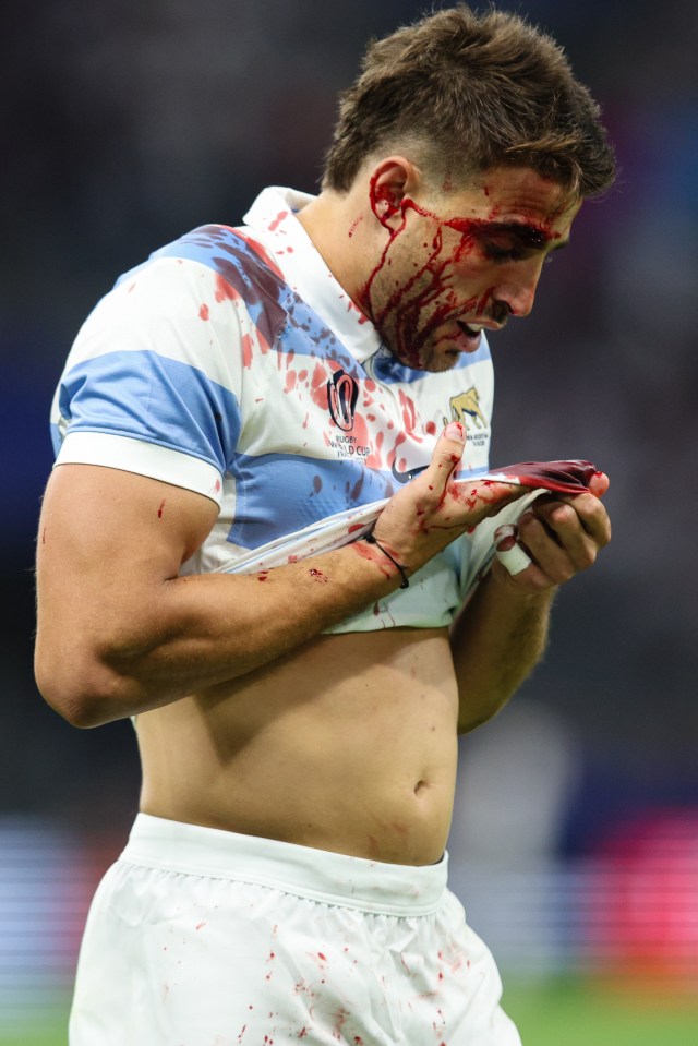 Juan Cruz Mallia was left a bloody mess following Curry's tackle