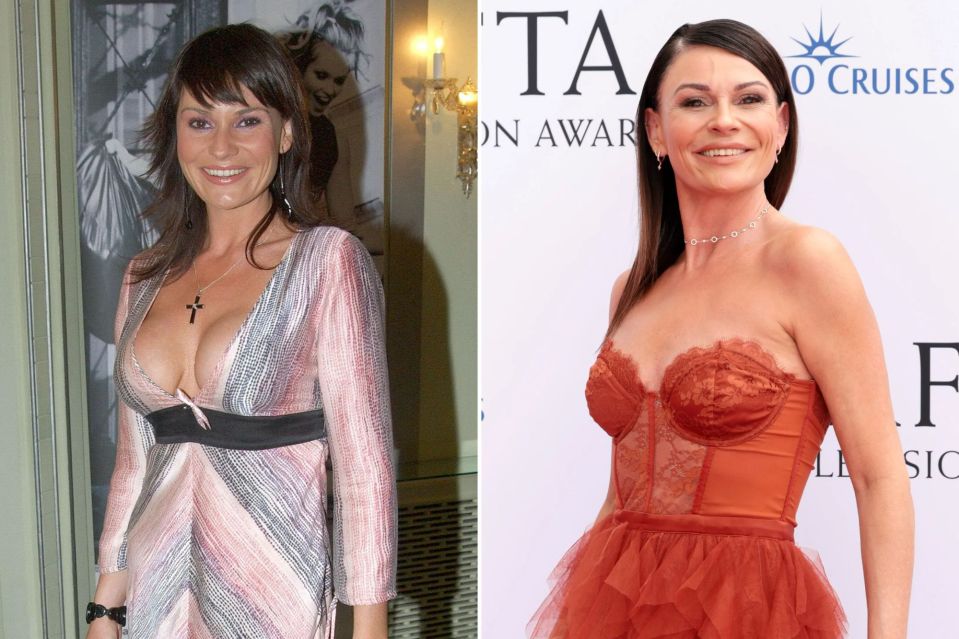 Emmerdale's Lucy Pargeter had her "toxic" breast implants removed in 2019