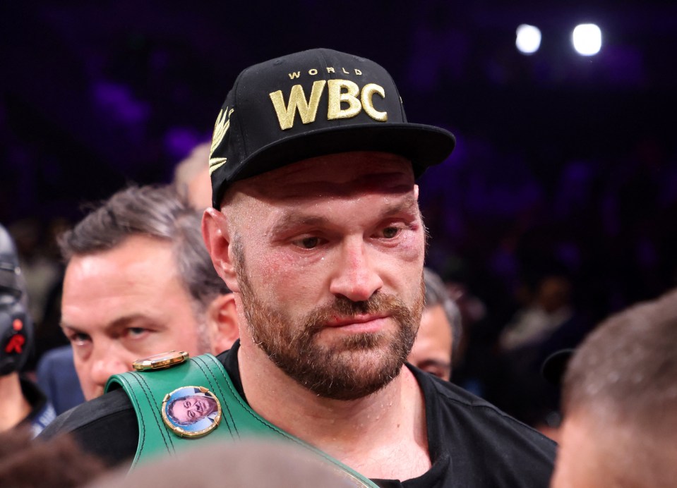 Tyson Fury came out of the fight with Francis Ngannou with a black eye and a cut on his forehead