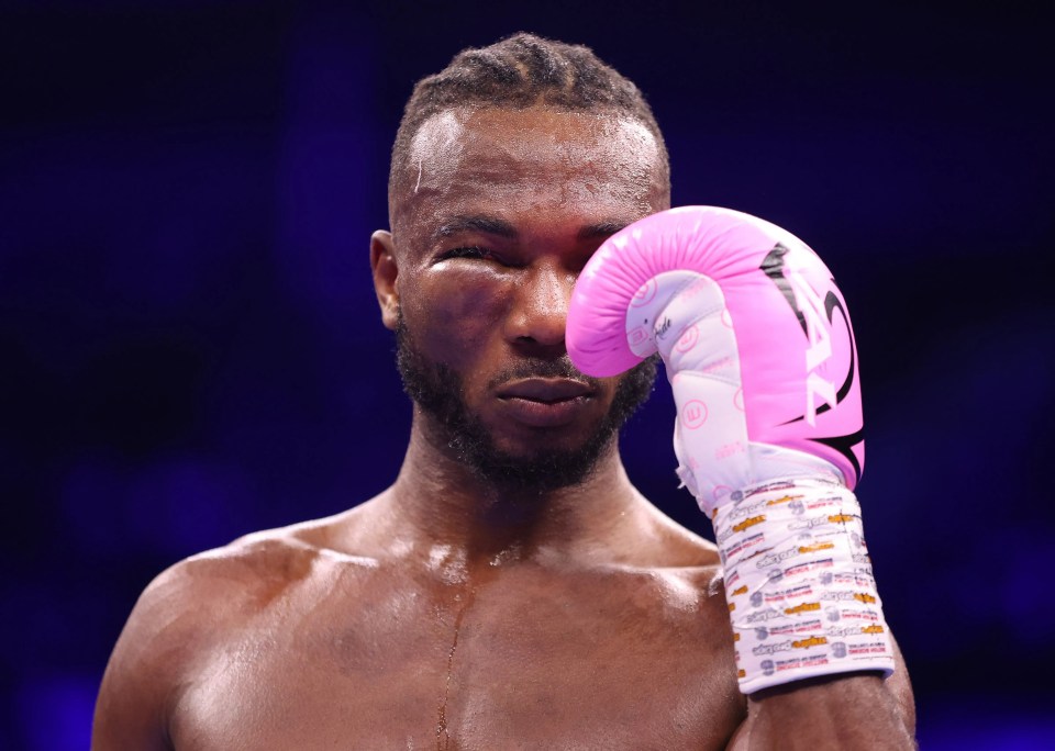 The referee had to stop the fight in the sixth round due to the injury