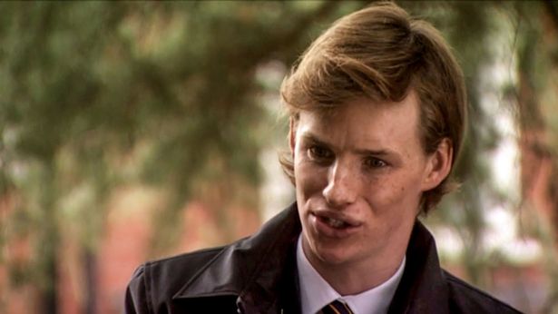 Eddie Redmayne played Rob Huntley in a 2003 episode of Doctors