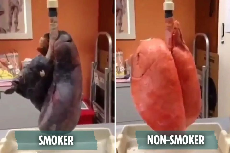 A video shared to Instagram laid bare how radically cigarettes can alter your lungs