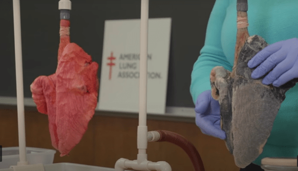 The American Lung Association showed how differently a smoker and non smoker's lungs take in oxygen