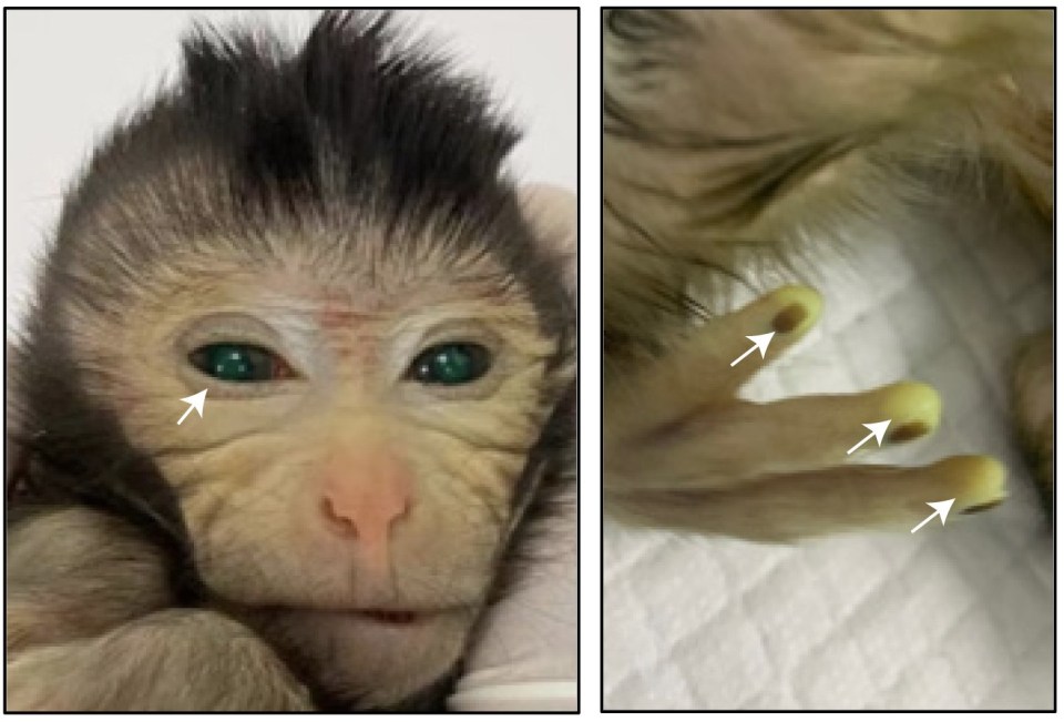 The chimeric monkey is the first of its kind, after results seen in mice and rats