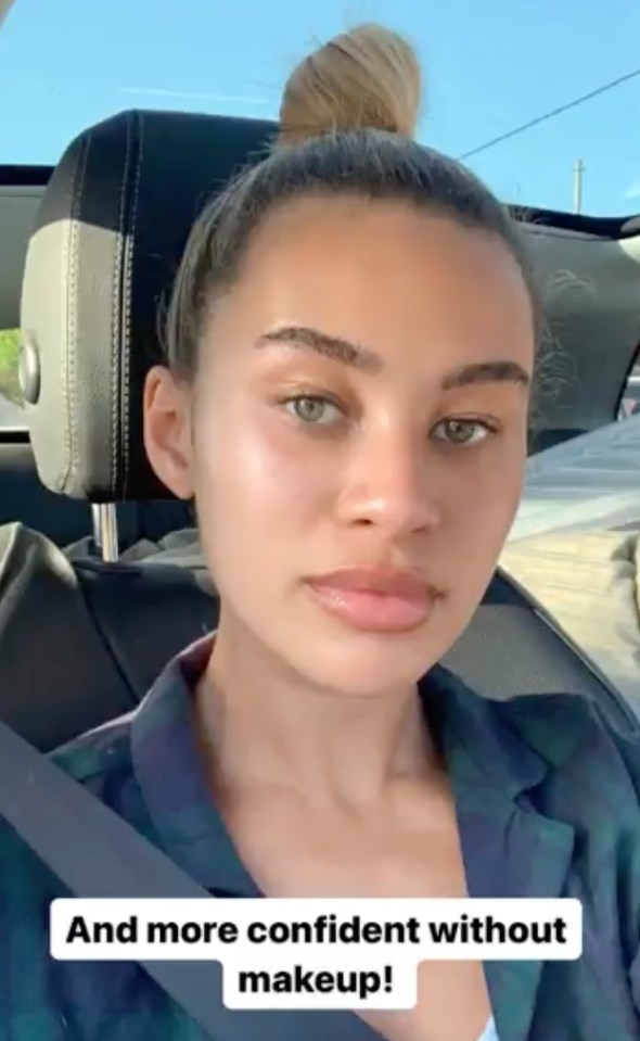 Montana has shown off the results of getting her facial filler dissolved