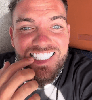 Sam Gowland has faced trolling over his veneers