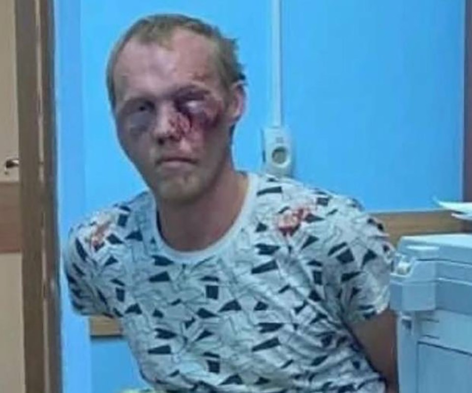 He was later seen blood-faced after police officers beat him up for the alleged crime