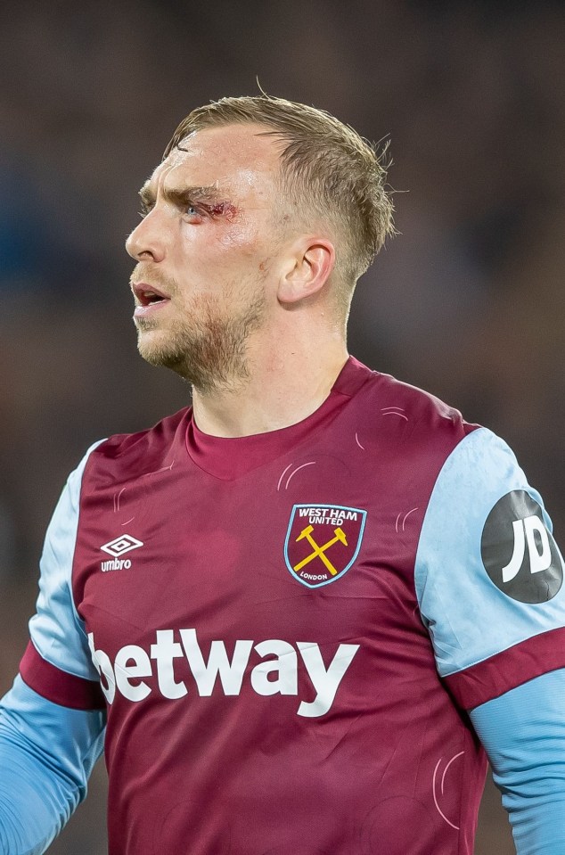 The West Ham winger was left bleeding above his eye