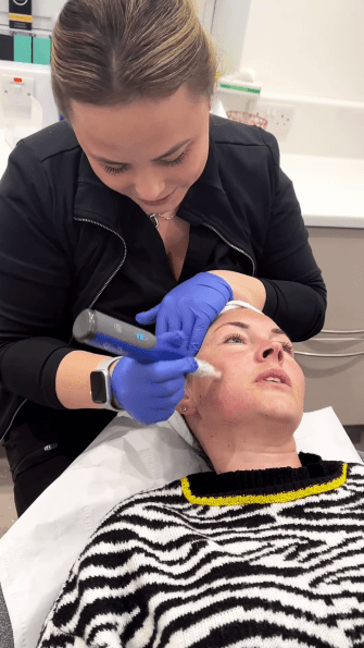 Lacey Turner underwent a collagen enhancing micro-needling treatment