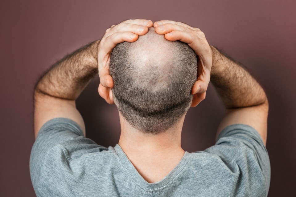 Cold weather in winter can accelerate hair loss, according to pharmacist Abbas Kanani