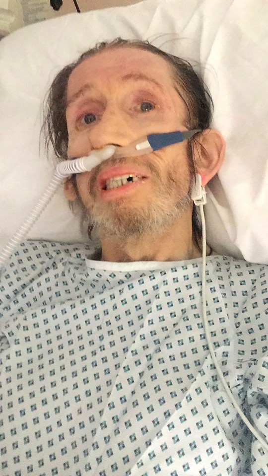 Pogues frontman Shane MacGowan was hospitalised after being diagnosed with viral encephalitis last year and passed away of the illness