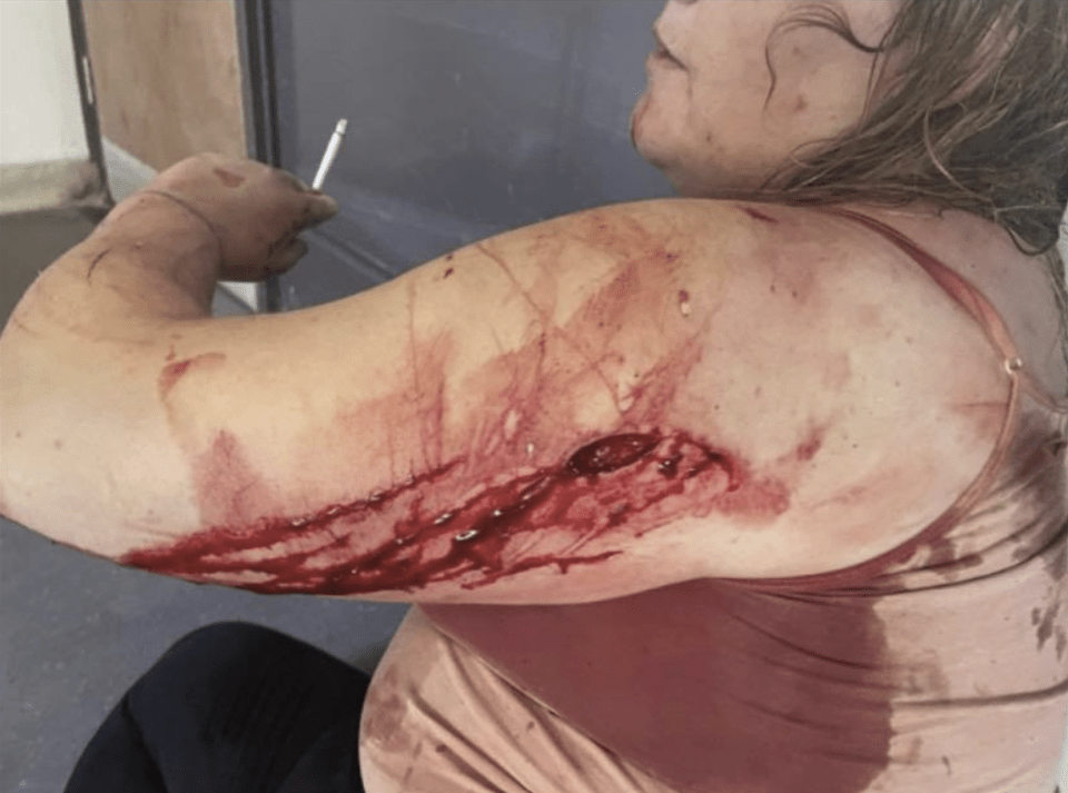 Monster Ross Komoroczky slashed at her with a broken glass bottle