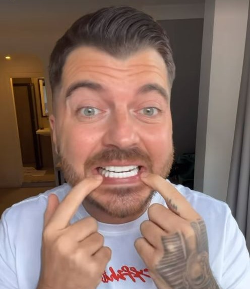 The MAFS star showed off the results of his dental implants