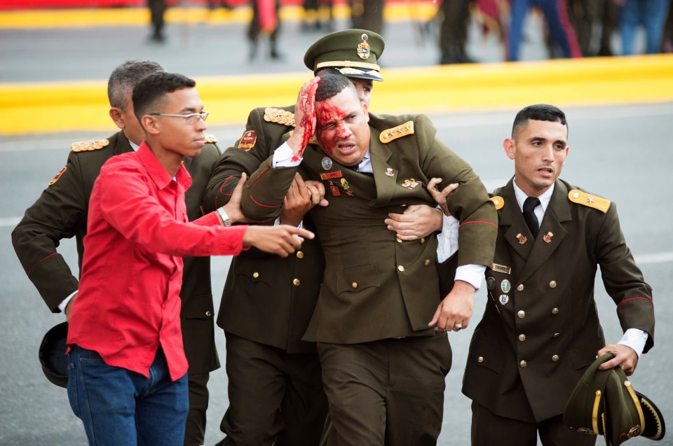 A uniformed Venezuelan official was pictured with head injuries following the drone blasts