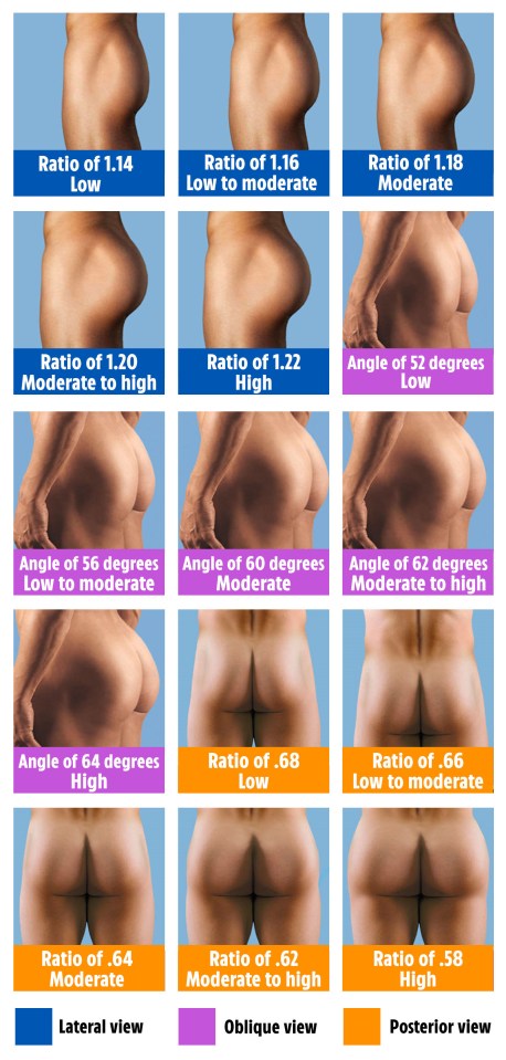 How the male bum scored in the study