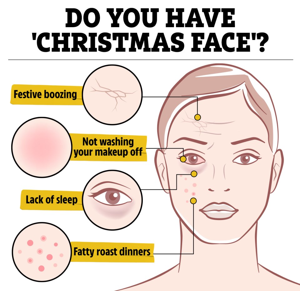 Diet changes over Christmas and drinking can take a toll on your skin