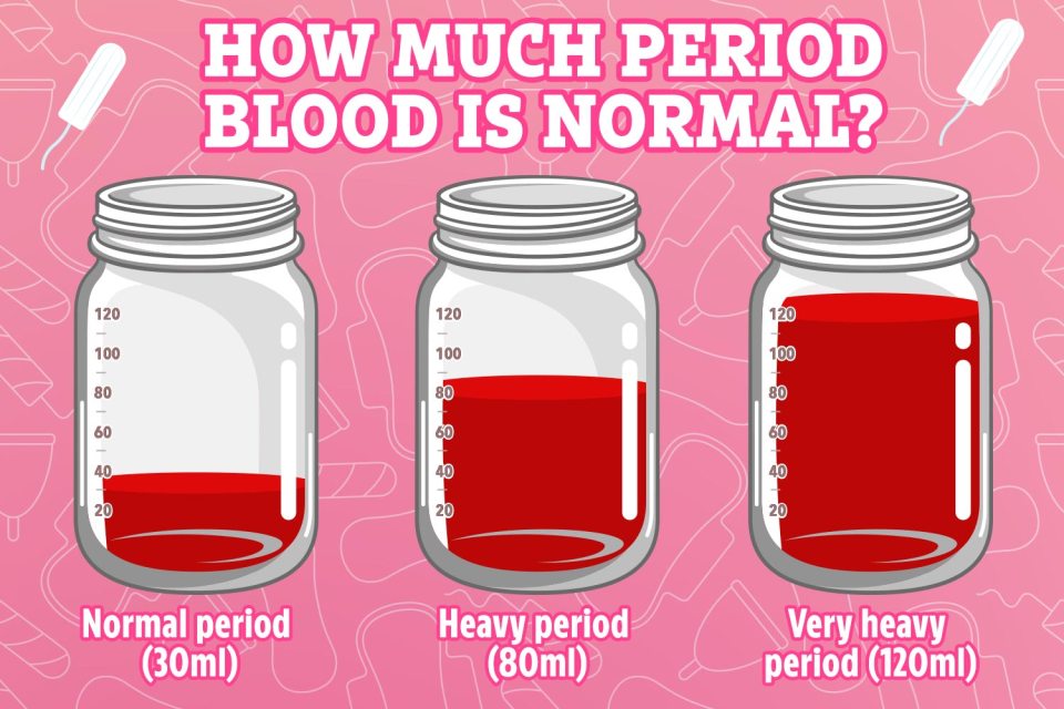 Losing 30ml of blood during a period is considered 'normal', more than 80ml is considered 'heavy'