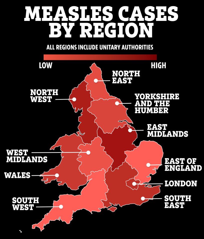 Map reveals most dangerous regions for measles