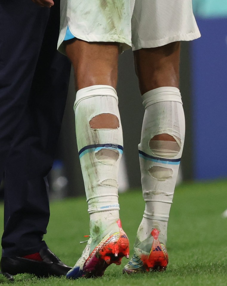 The star cuts holes in the back of his socks like a number of other top stars