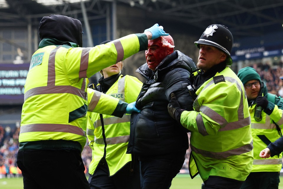 One fan was escorted away by police while receiving treatment for a horrific head injury