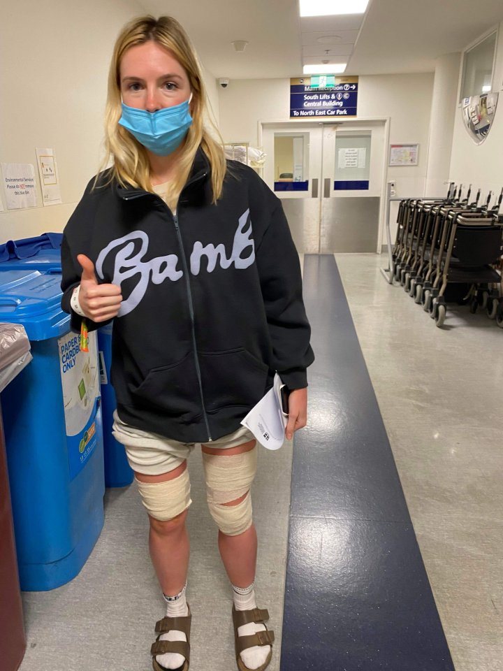 Her legs bandaged after having her blisters drained in hospital on January 2