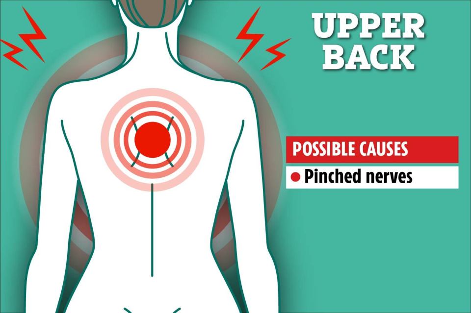 Pain in the upper back can be caused by pinched nerves, experts say