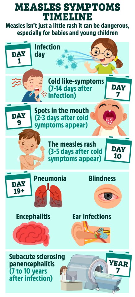 How measles can affect the body: from rash to brain swelling disease