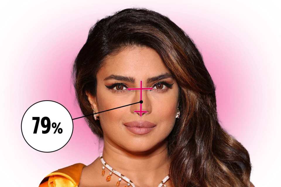 Priyanka Chopra has had corrective surgeries to fix a botched nose job