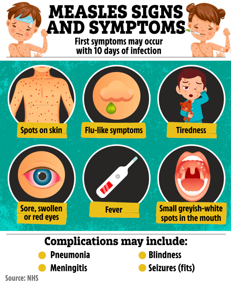 Doctors have warned that measles isn’t a minor illness and it could result in severe complications