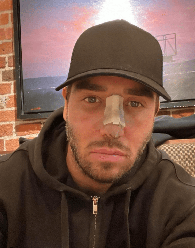 James Lock took to Instagram as he gave details on his recovery after sustaining gruelling injuries