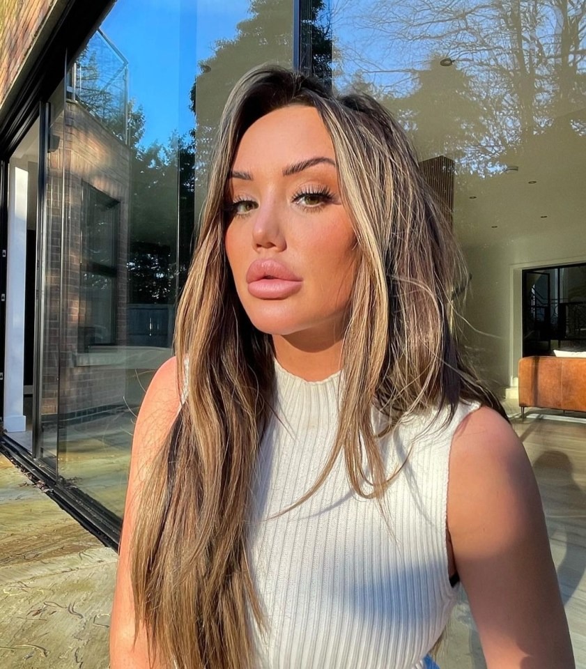 Charlotte Crosby often showed off her plumped up pout before getting it dissolved