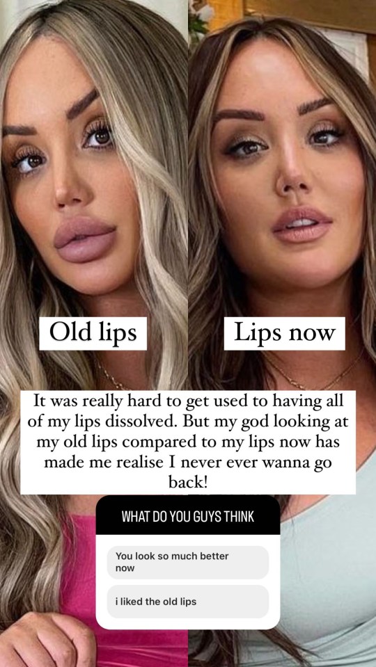 Charlotte Crosby shared before and after snaps of her lips on Instagram