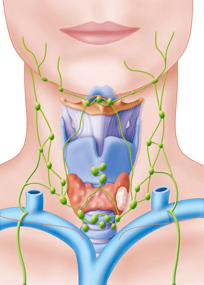 Thyroid cancer mainly affects women as is not that common in the UK