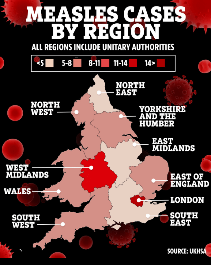 Measles cases are spiking in London and the West Midlands, UKHSA data show