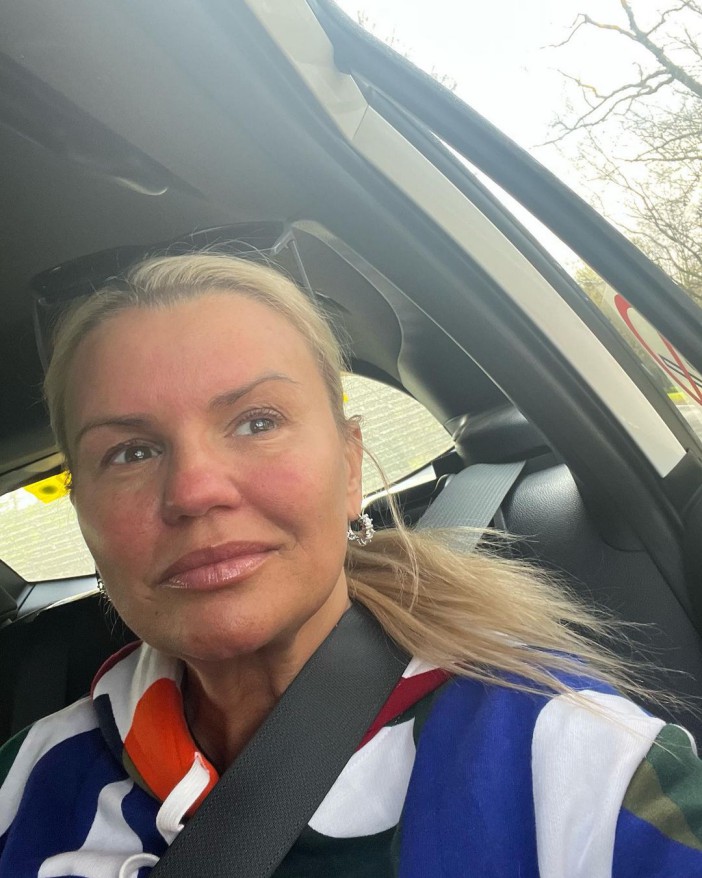 Kerry Katina has talked candidly about her eyelift