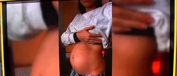 The mum revealed her pregnancy of two sets of identical twins was super rare