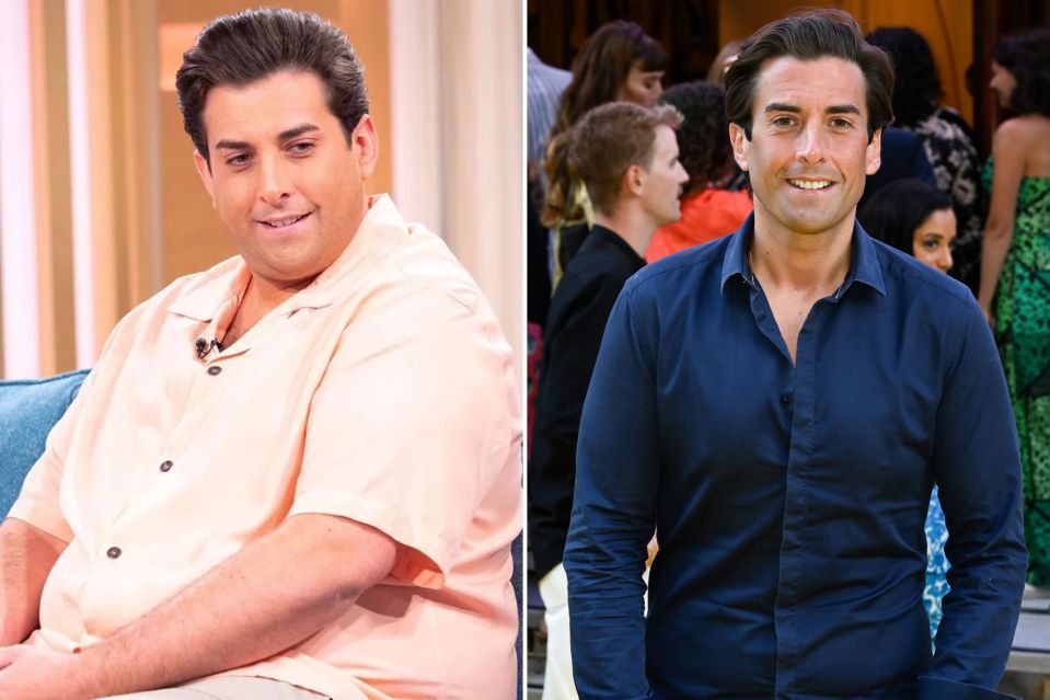 James Argent required lifesaving surgery after struggling with his weight