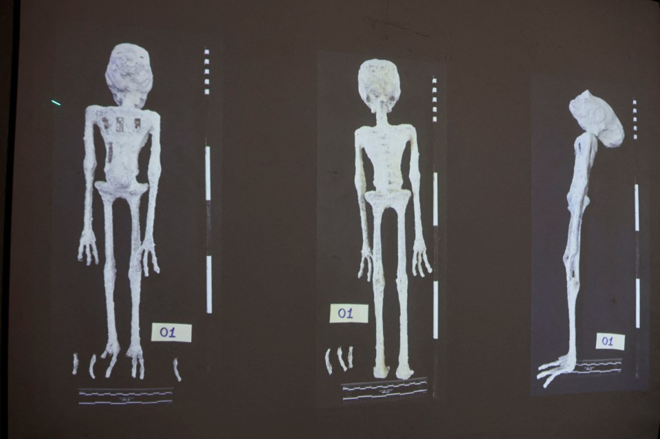 An X-rays and study carried out by the Institute of Legal Medicine of Peru on the ‘alien mummies’ concluded that they are dolls