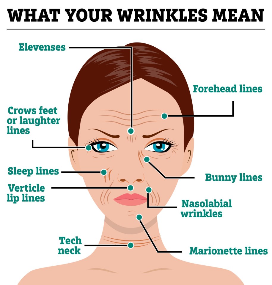 a diagram of a woman 's face shows what your wrinkles mean